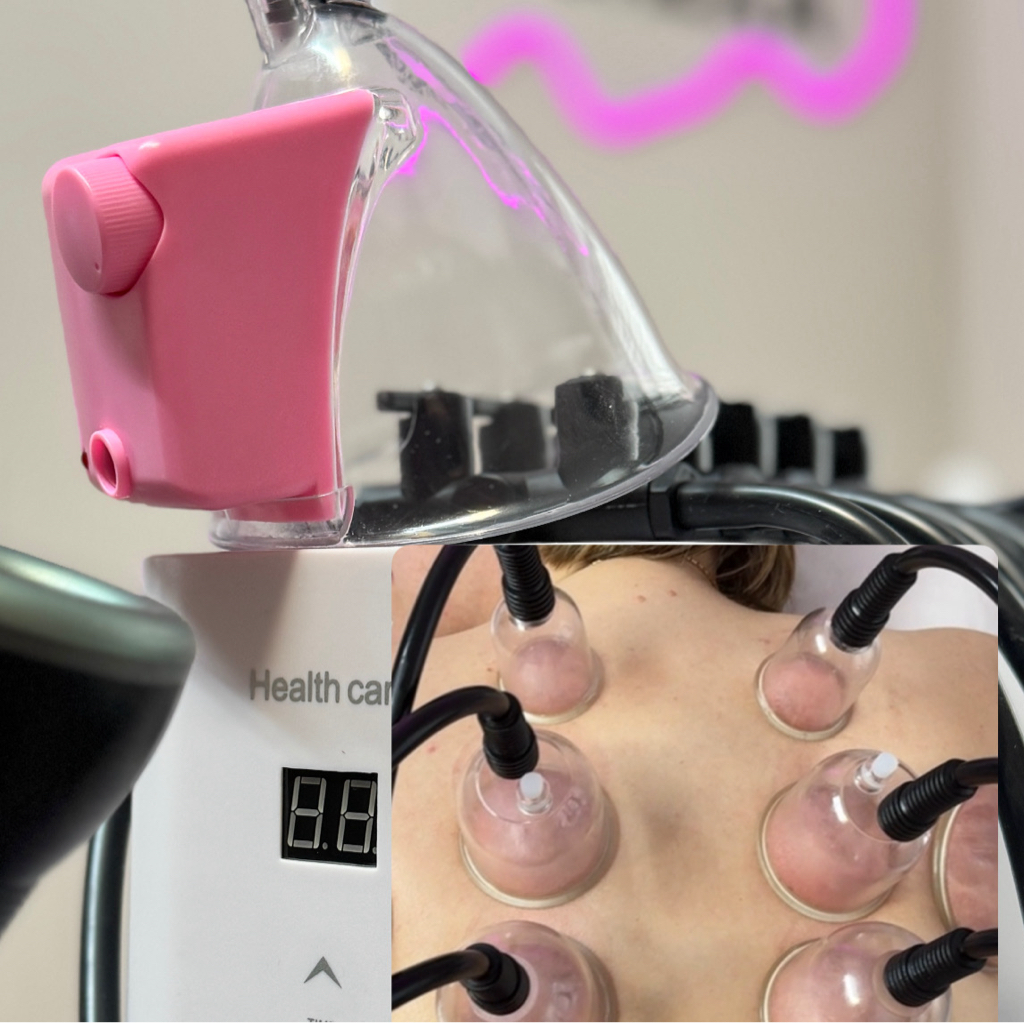 «Паук» Вакуумно-баночный метод (30 мин.)