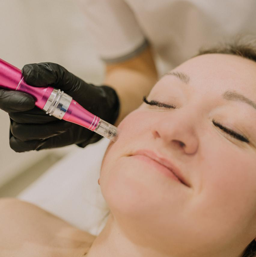 Фракционная мезотерапия кожи лицо, шея, декольте, кости рук