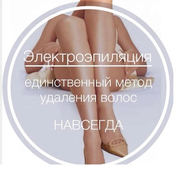 Электроэпиляция