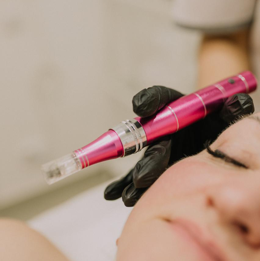 Фракционная мезотерапия кожи волос