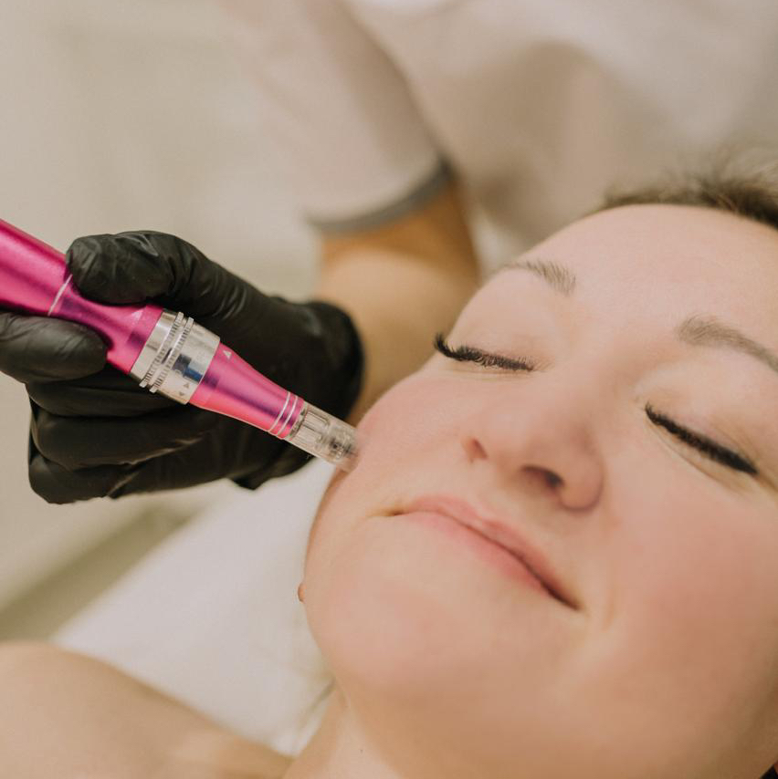 Фракционная мезотерапия