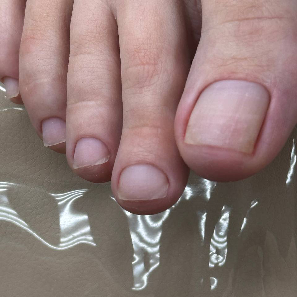 🦶Smart-Педикюр (стопы +обработка пальчиков)