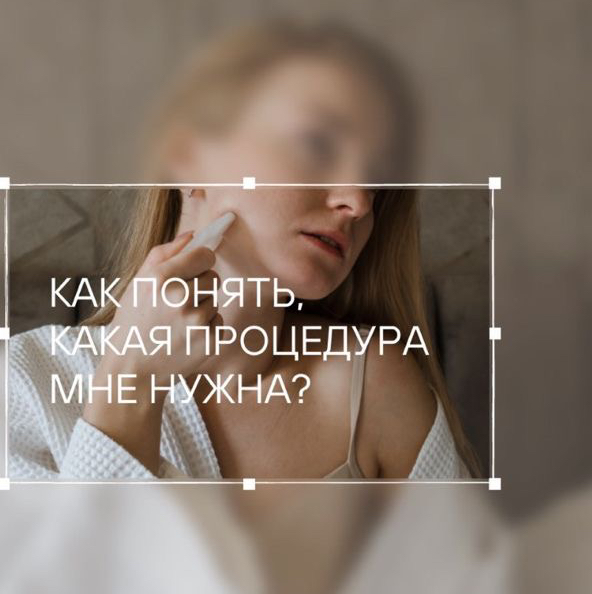 Консультация
