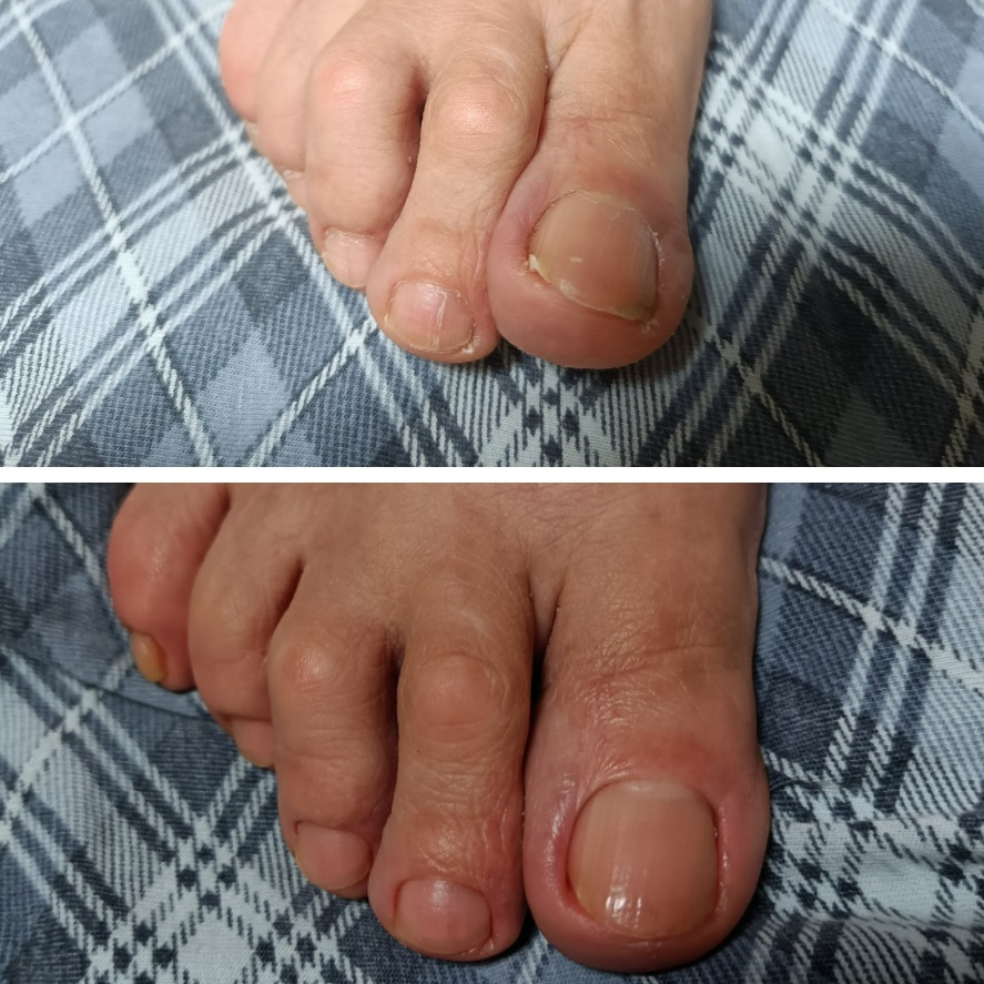 Снятие гель-лака обработка пальчики