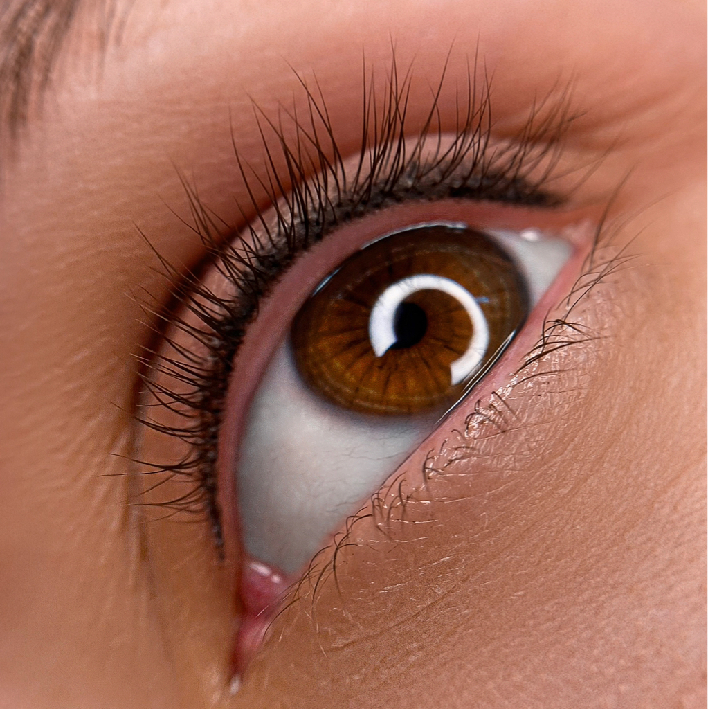 Межресничка