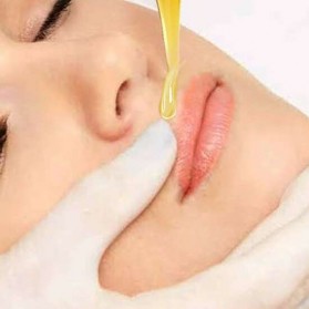 Верхняя губа