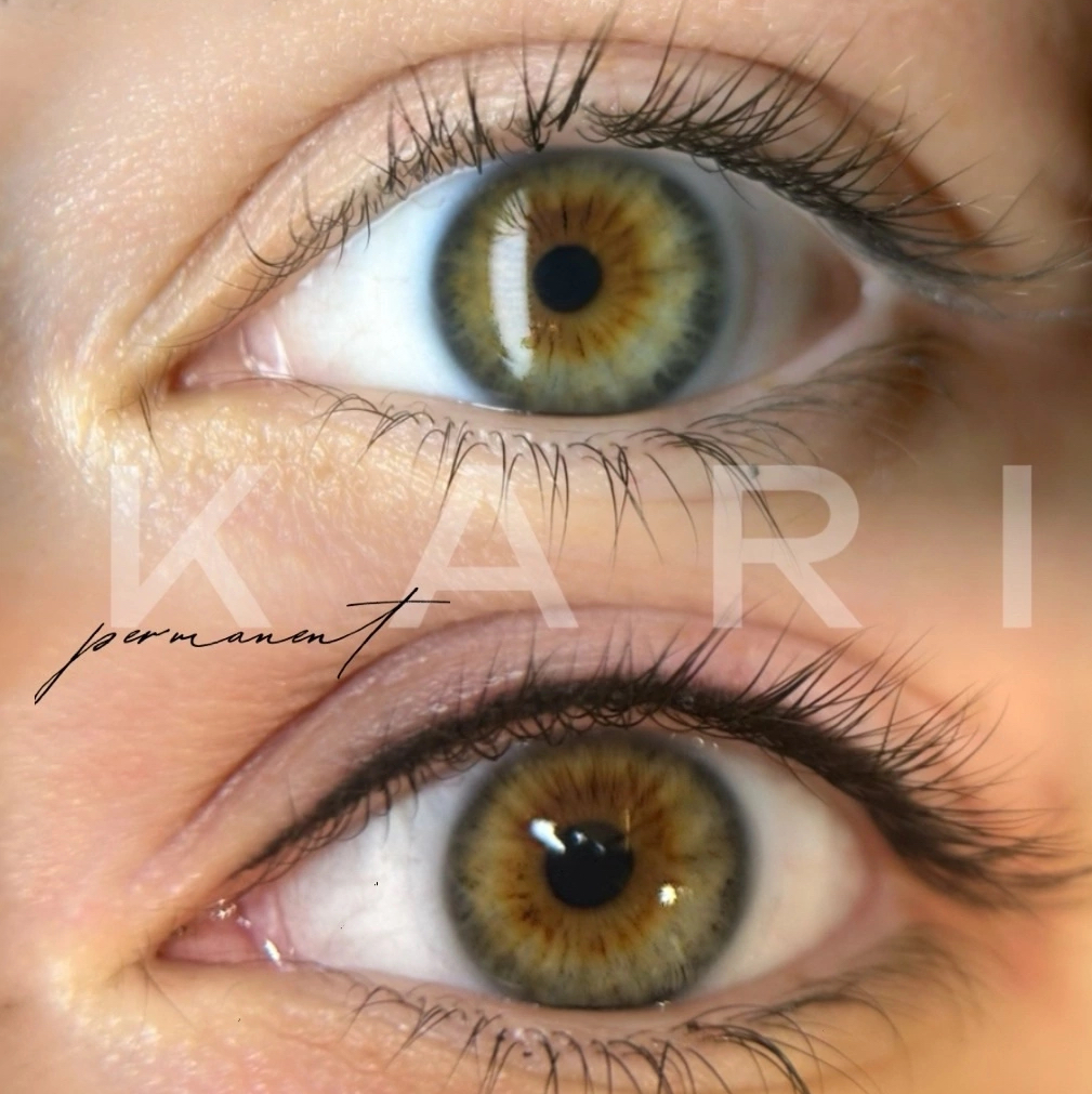 Межресничка