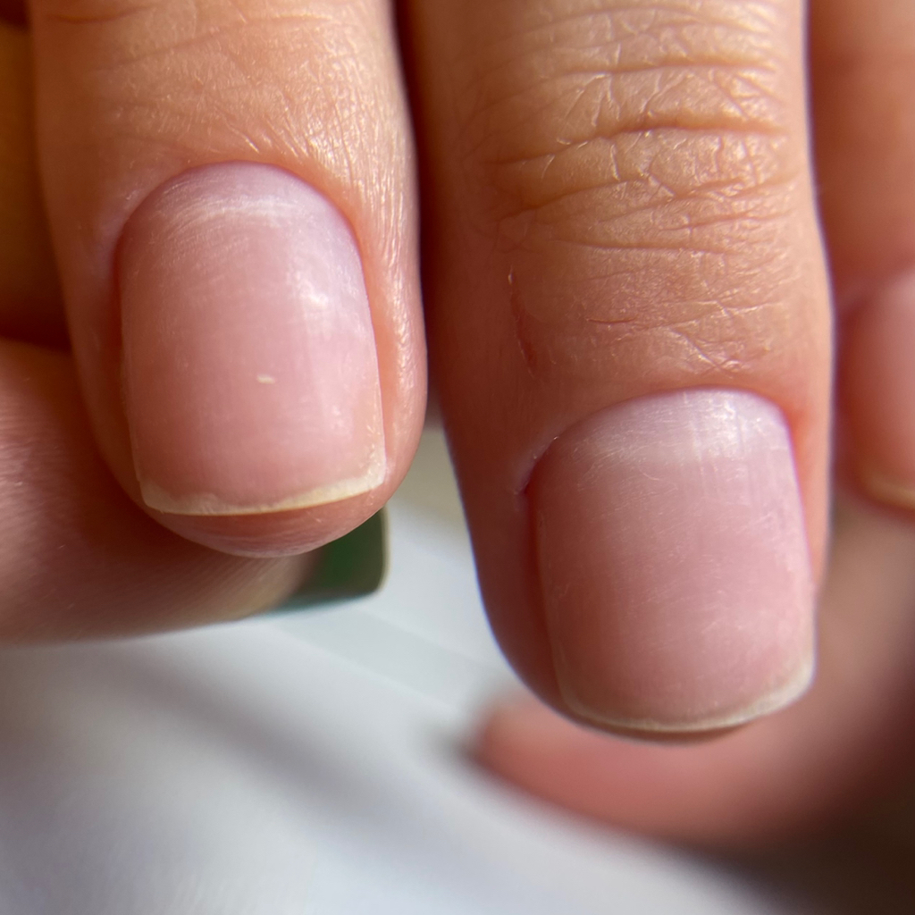 Снятие без последующего покрытия