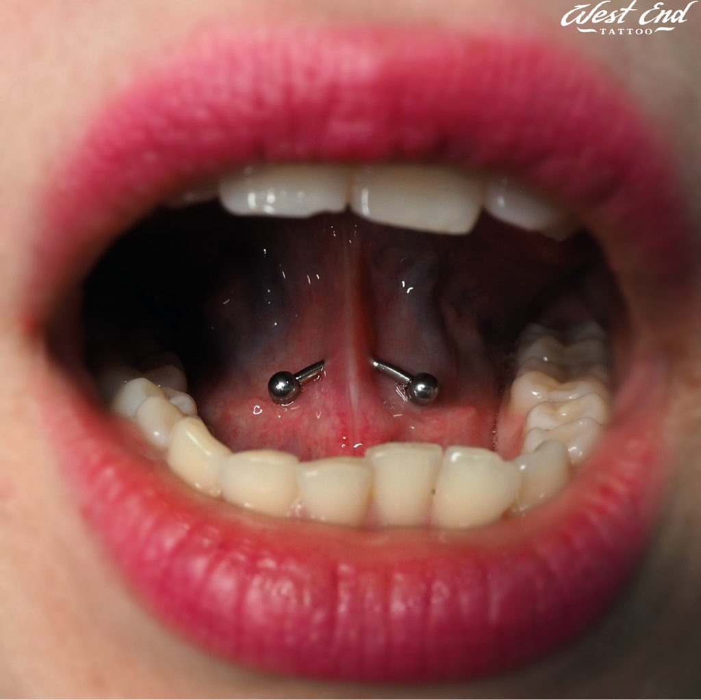 Прокол уздечки языка