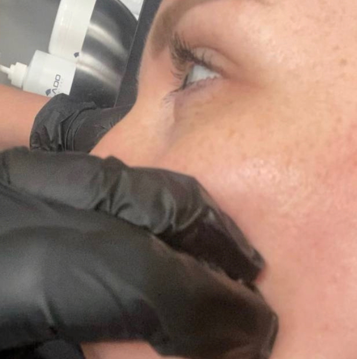 Буккальный массаж