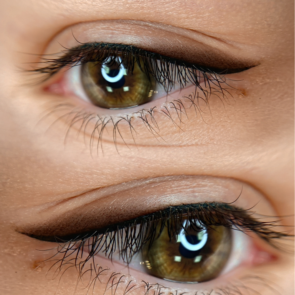 Коррекция стрелок не позже 2-х месяцев