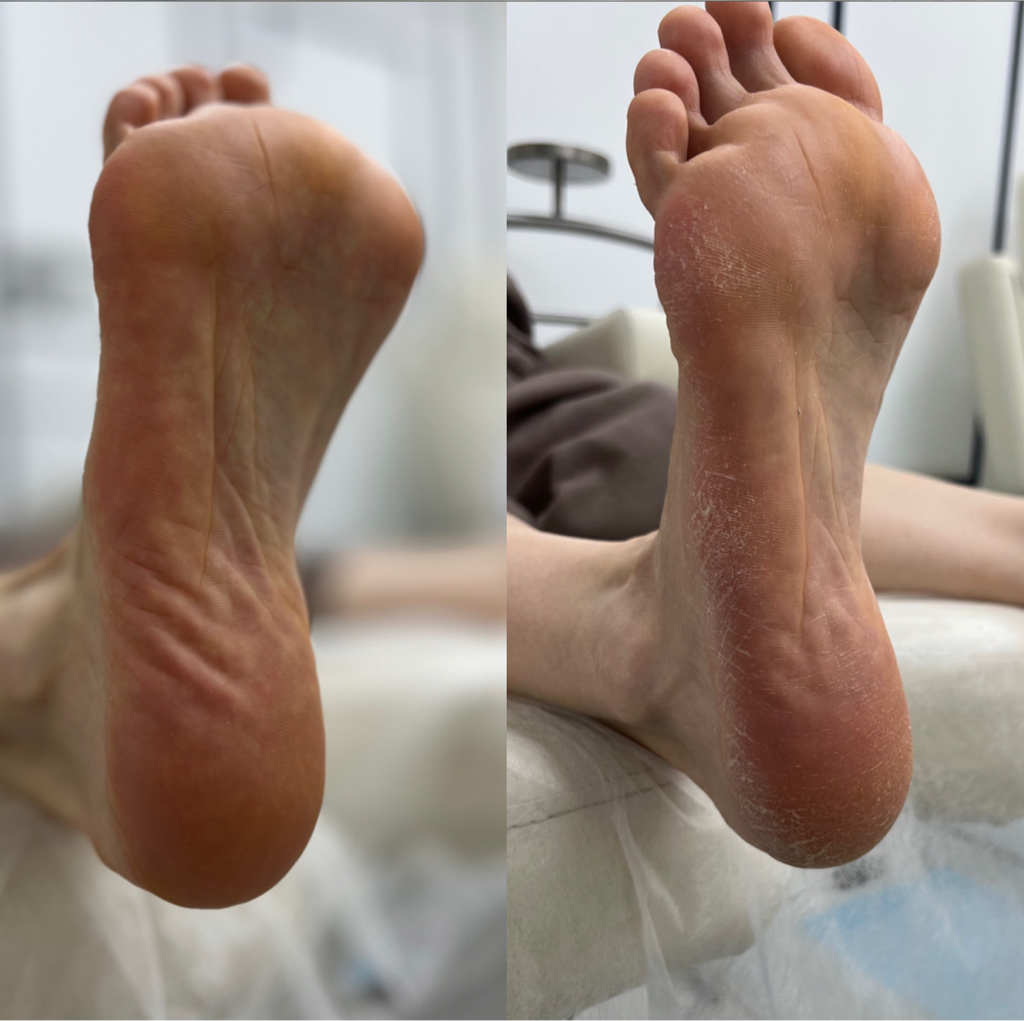 Педикюр  (полная обработка стопы и пальчиков)