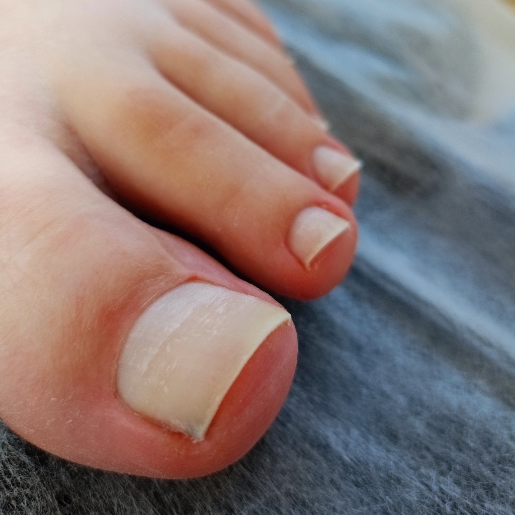 Гигиенический педикюр