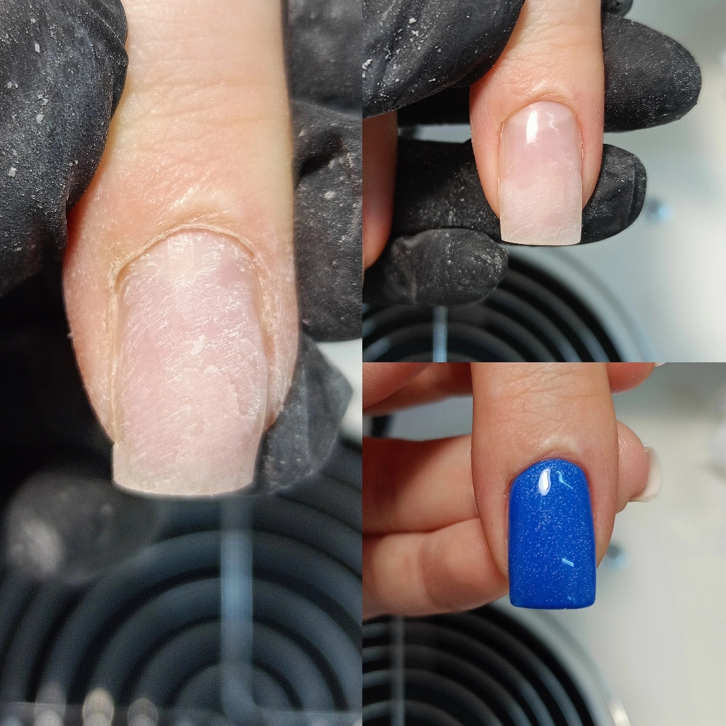 Ремонт ногтя