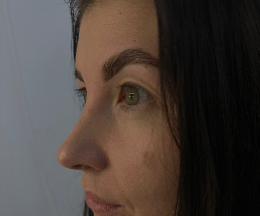 Комплекс «ДУ+оформление + окрашивание бровей»