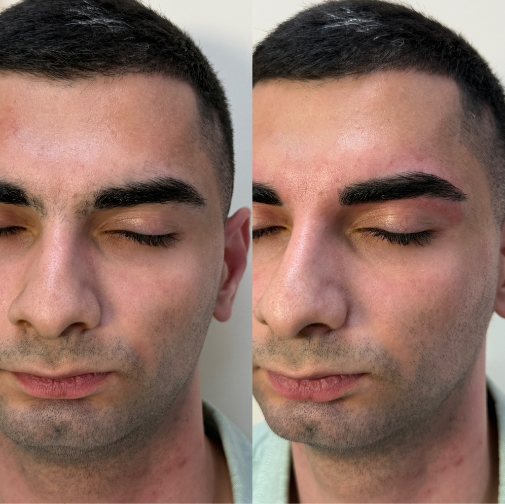 Мужская коррекция