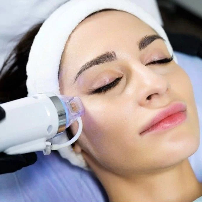 Микроигольчатый RF лифтинг лицо