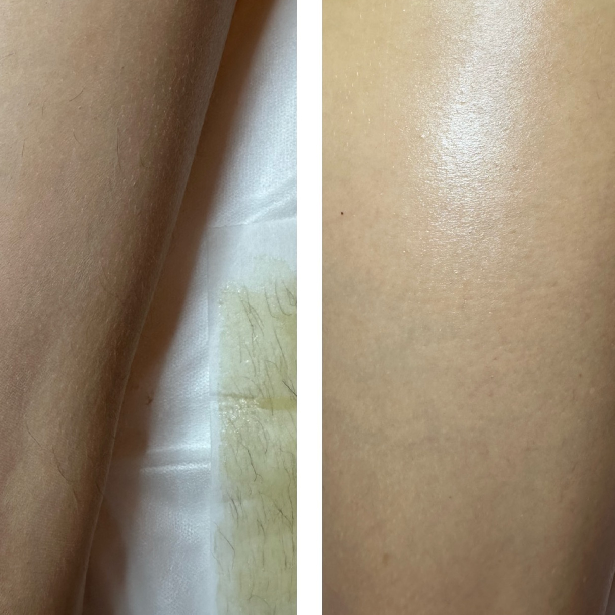 Legs waxing