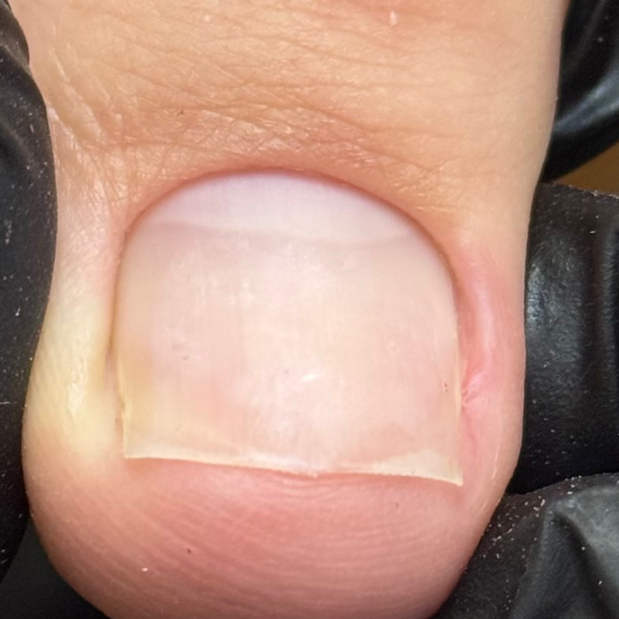 Снятие+обработка (пальчики без покрытия)