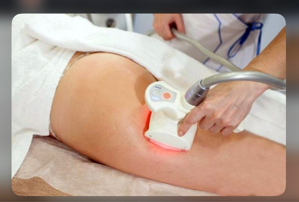 LPG массаж по маслу + RF лифтинг + кавитация