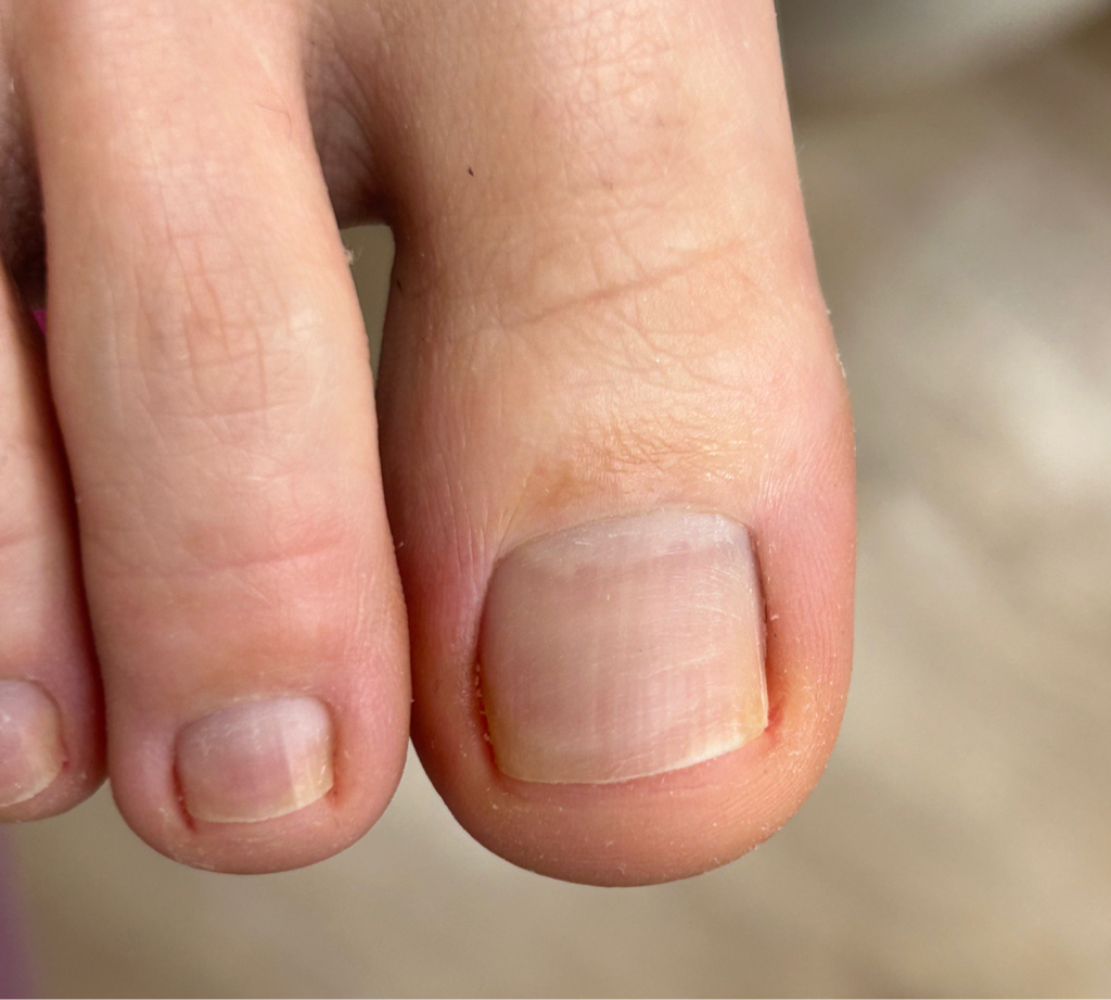 Обработка пальчиков без покрытия