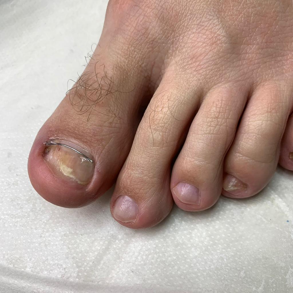 Мужской педикюр гигиенический