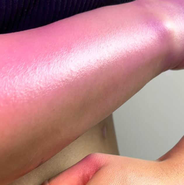 VIP ДЕПИЛЯЦИЯ: Руки по локоть