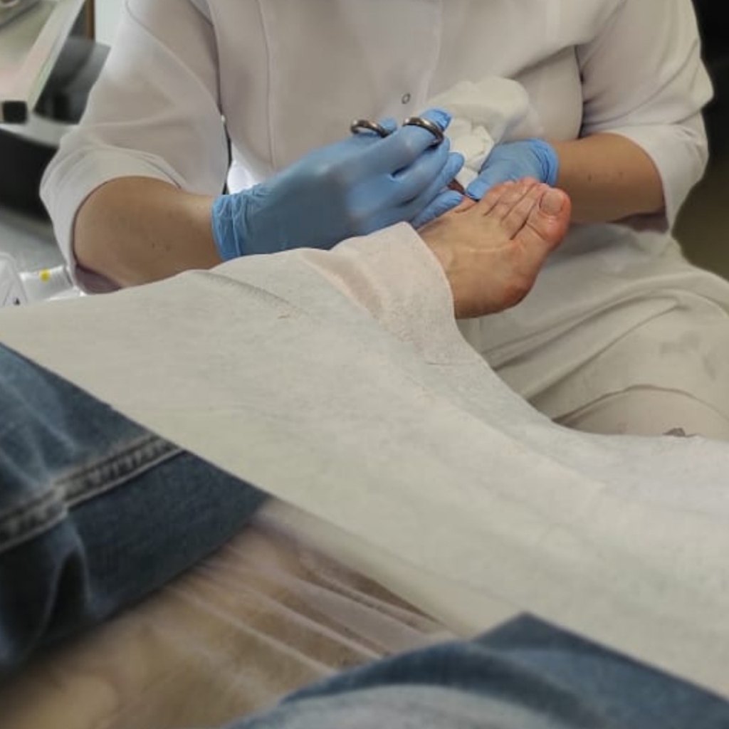 Подстригание ногтей на пальцах ног