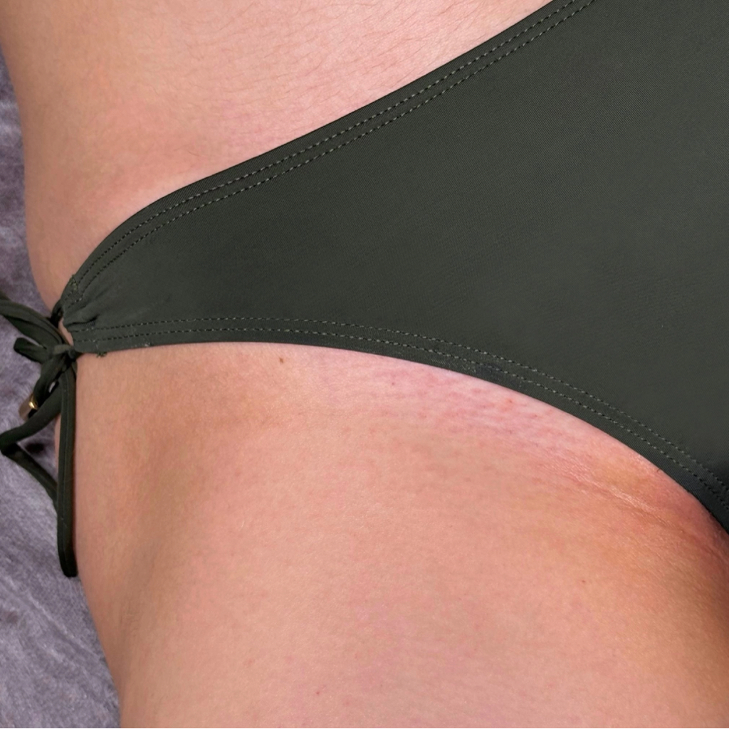 Бикини классика ( по линии трусиков)