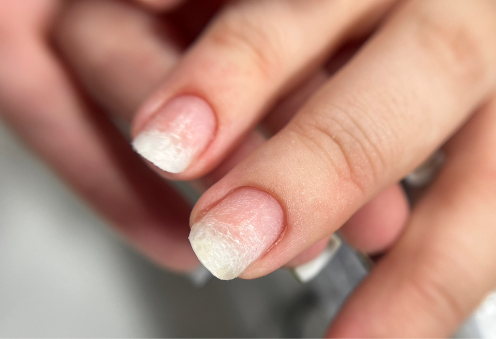 Снятие чужого материала с последующим покрытием