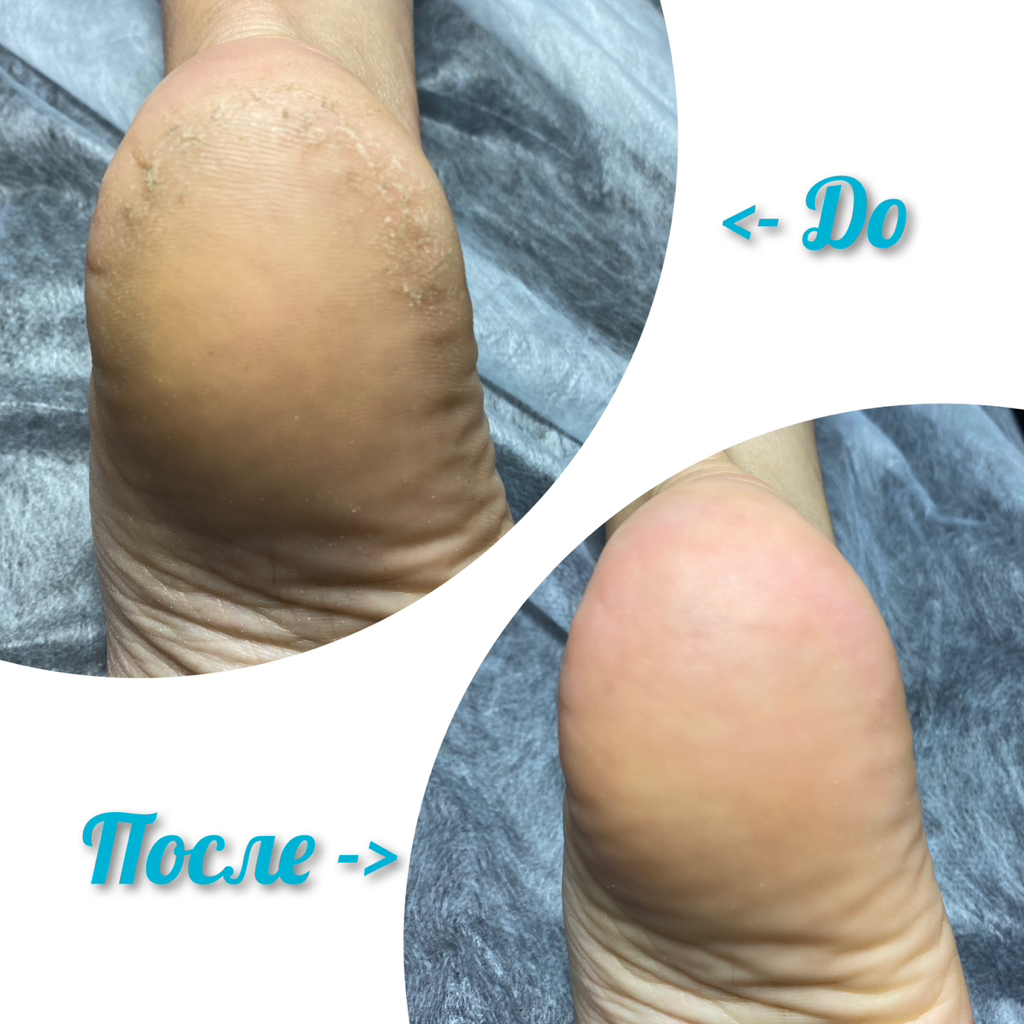 Педикюр, без покрытия