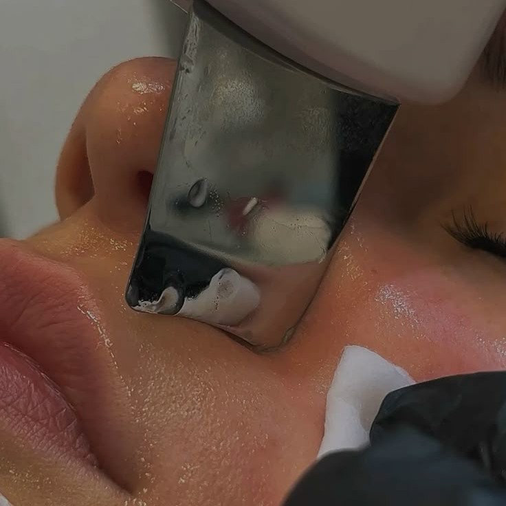 КОМПЛЕКС АнтиАкне+УЗ чистка/COMPLEX Anti-Akne + Ultraschallreinigung