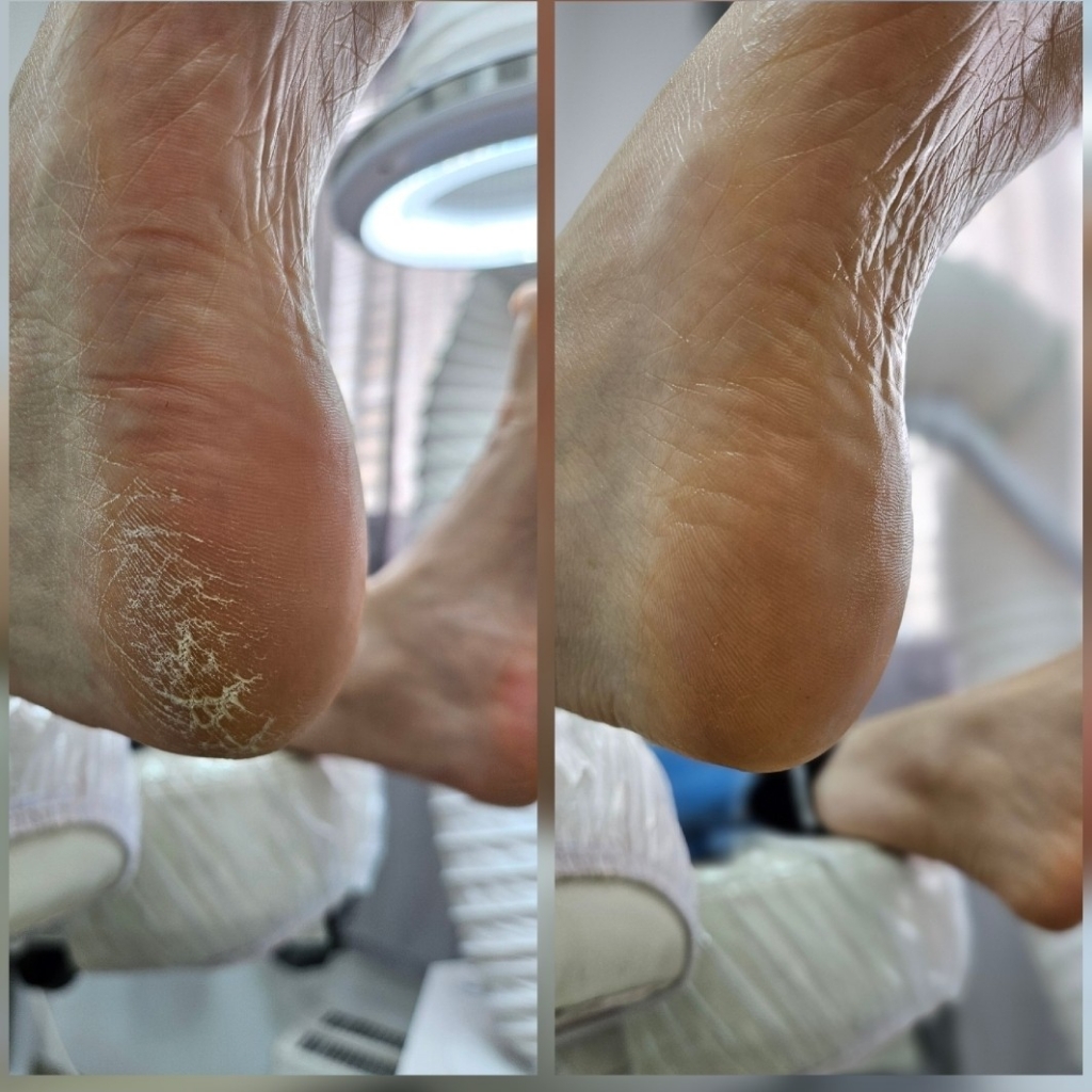 Smarticure LUX-педикюр (без покрытия)