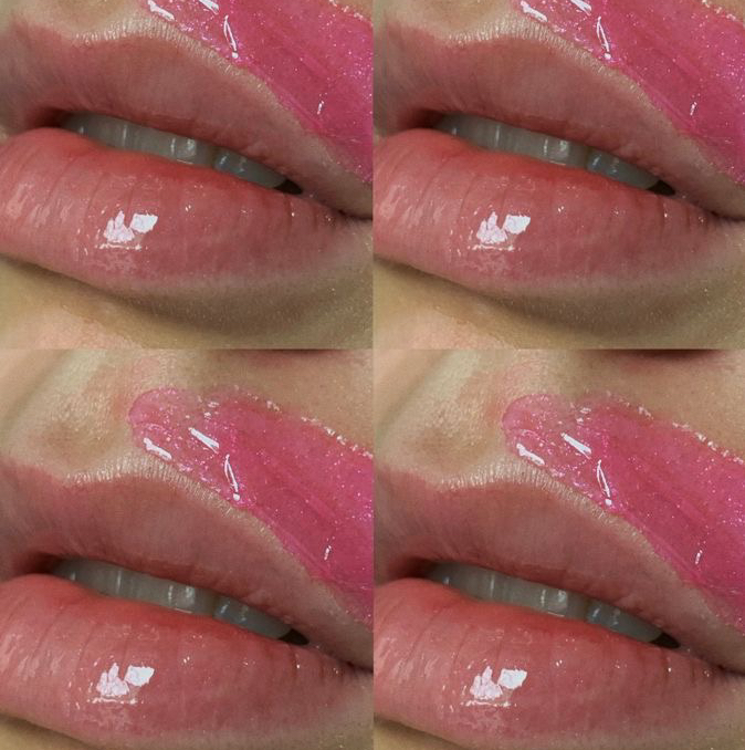 Удаление нежелательных волосков (1 зона)