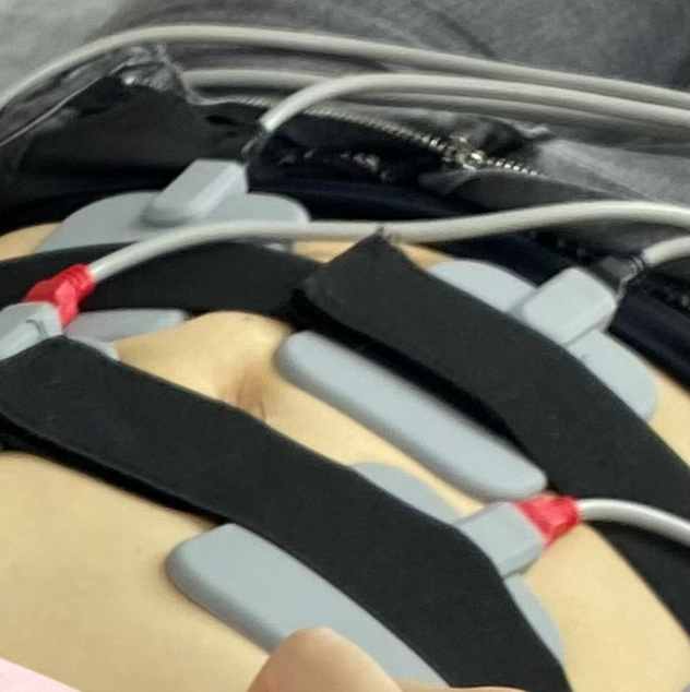 Коррекция фигуры ( мио) разовая процедура