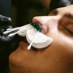 Удаление нежелательных волос воском (уши, нос, зона между бровей)