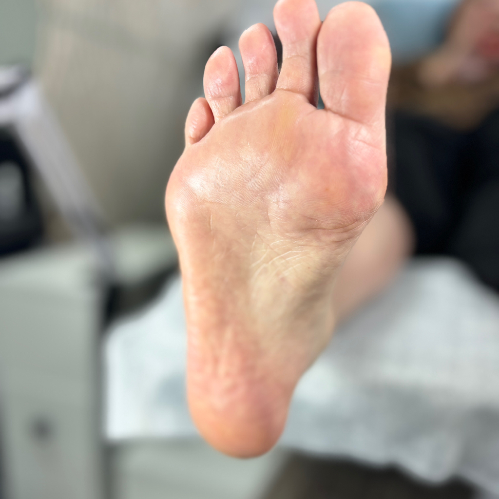 COMFORT   Пальцы без покрытия и обработка стоп