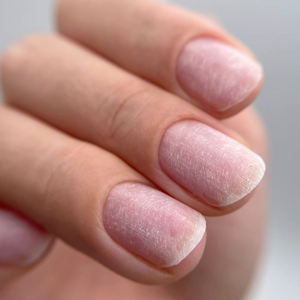 Снятие покрытия на руках