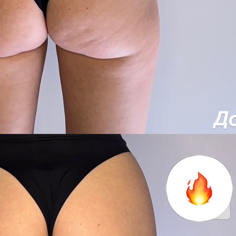 Massage Therapist & Wellness