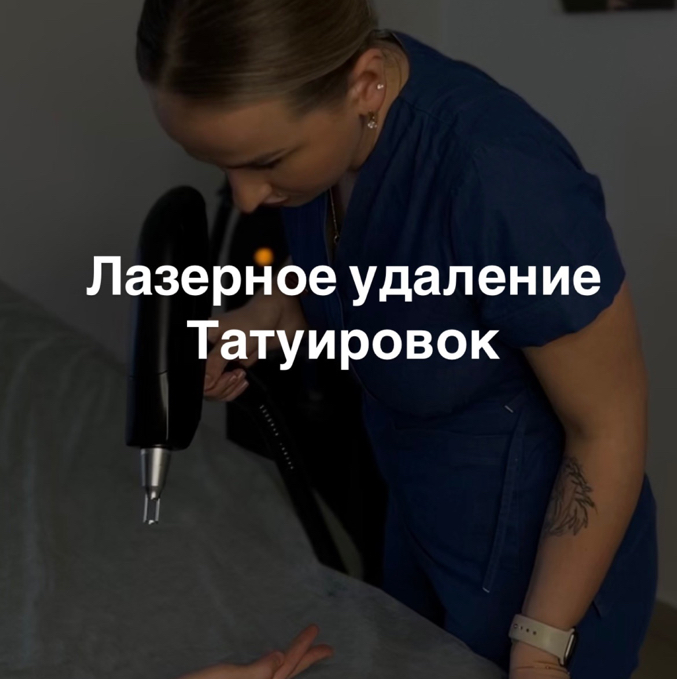 Лазерное Удаление татуировок