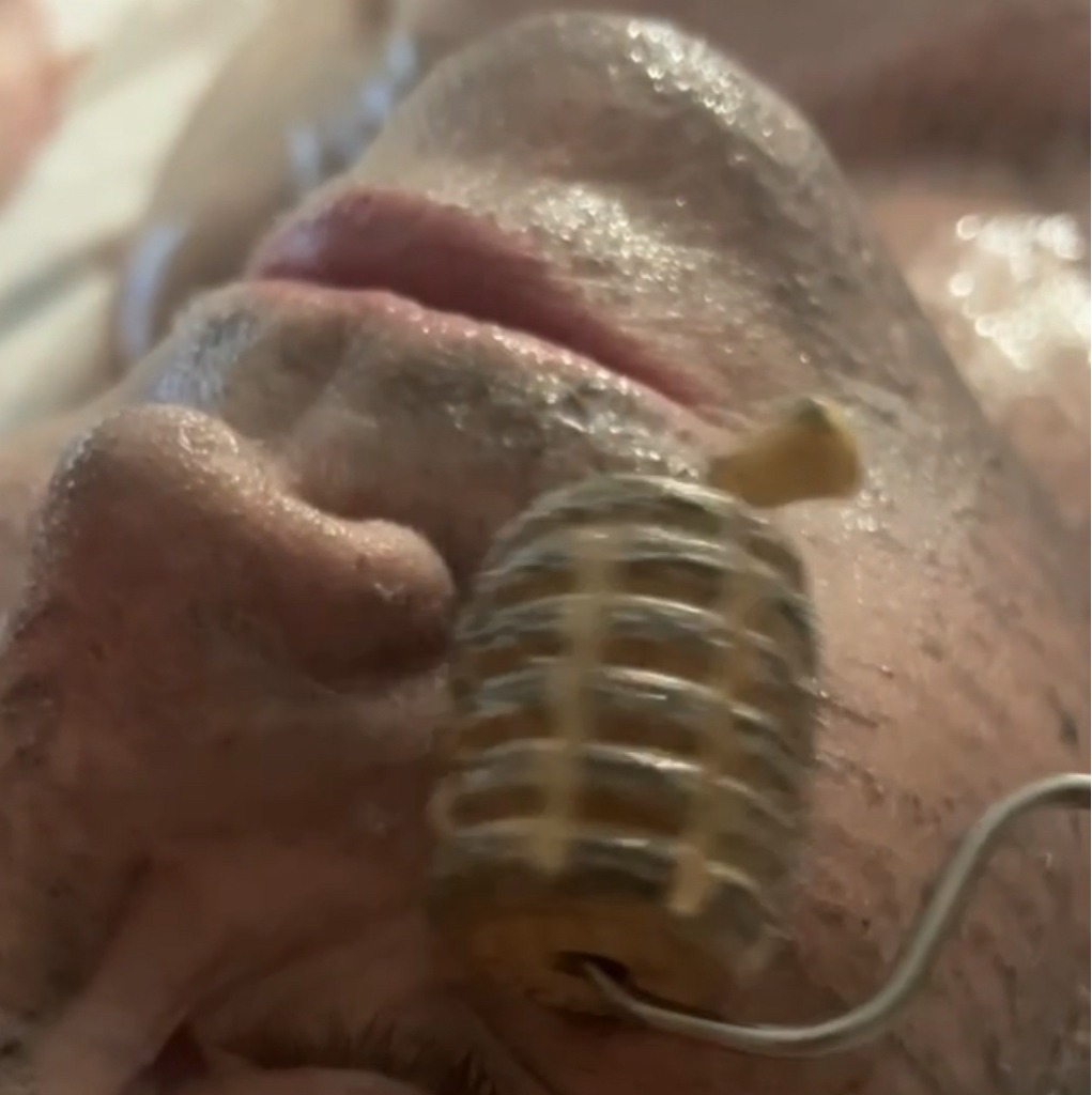 Ручная мадеротерапия лица/шеи/декольте ( медовый+ручной) 60 минут