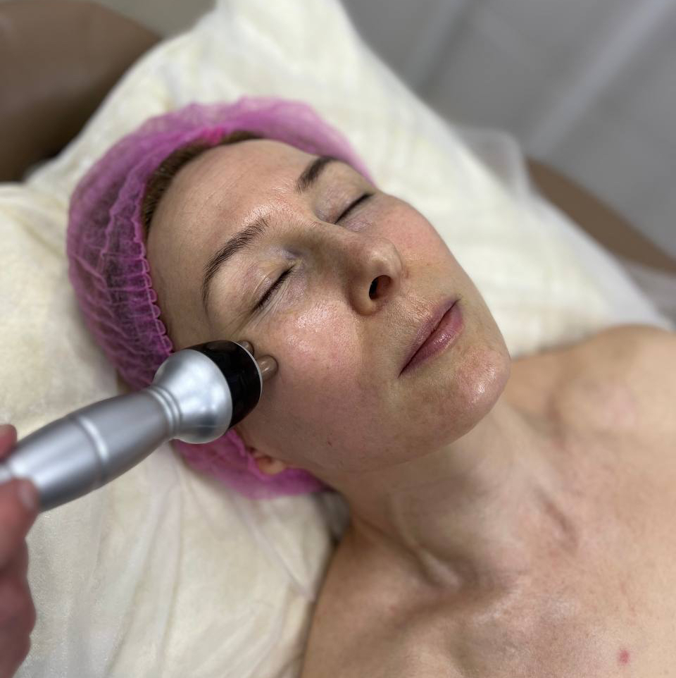 RF на сыворотке MS Estetique