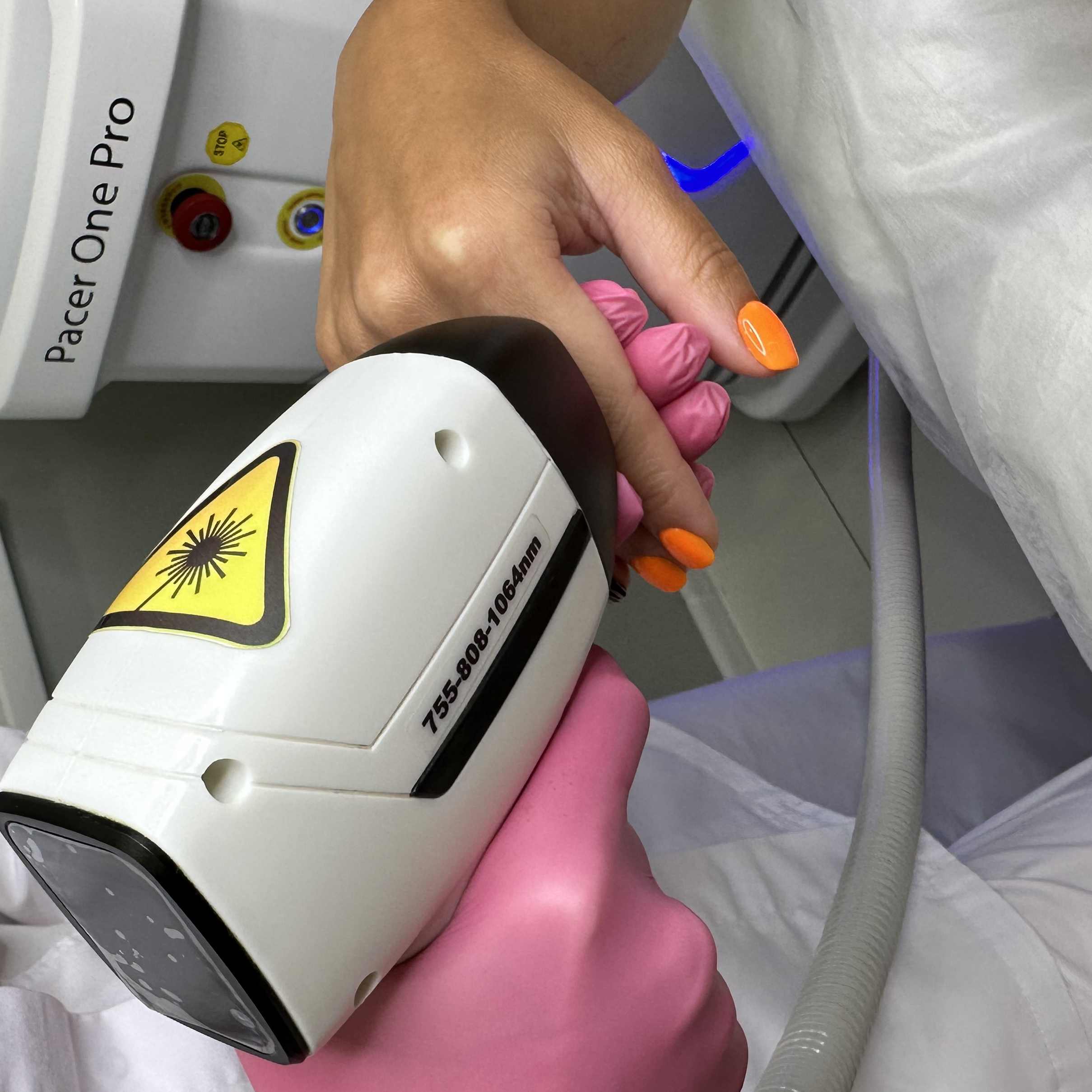 Лазерная эпиляция/ Руки полностью