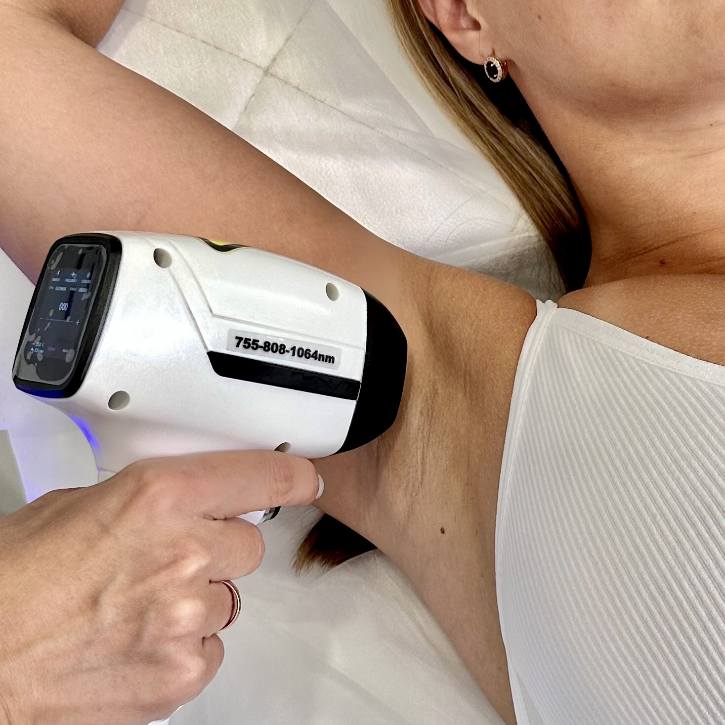 Лазерная эпиляция/ Подмышки