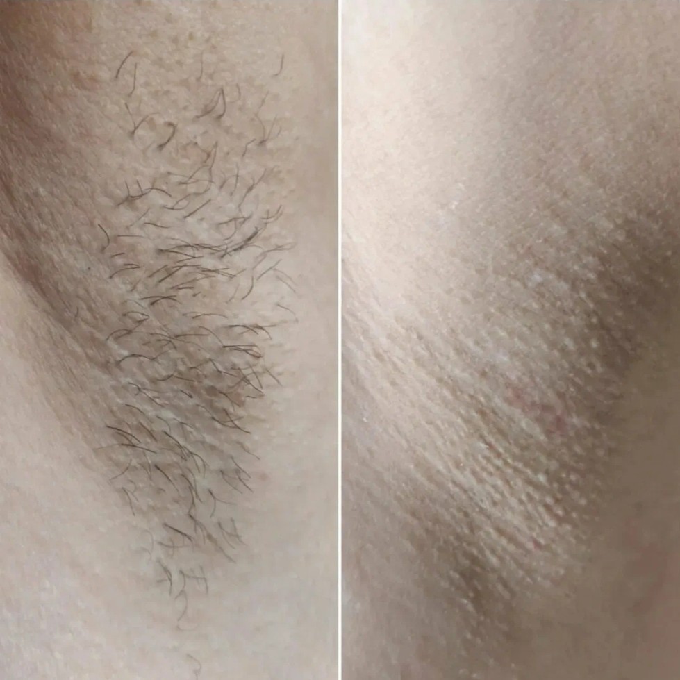 Подмышки! Депиляция для женщин! Шугаринг / Ваксинг