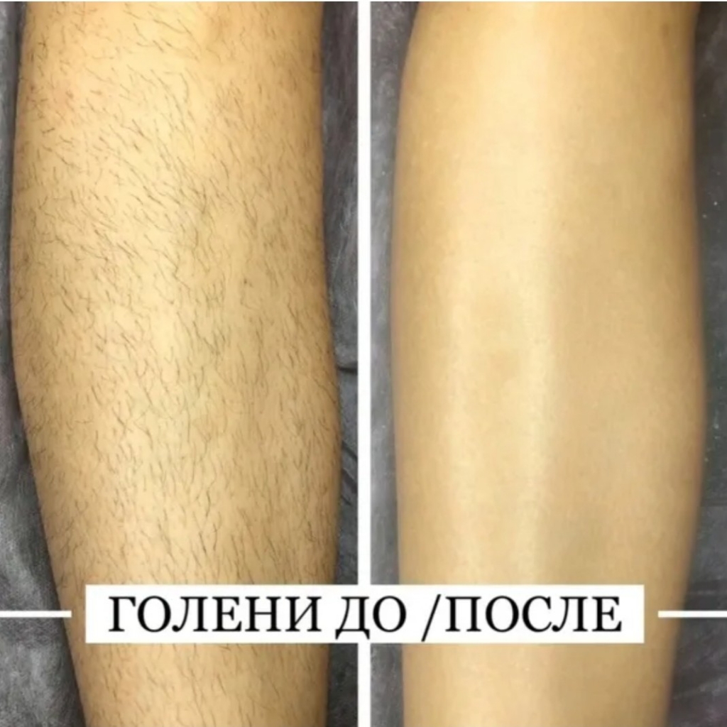 Голень/Бедро!Депиляция для женщин!Шугаринг / Ваксинг