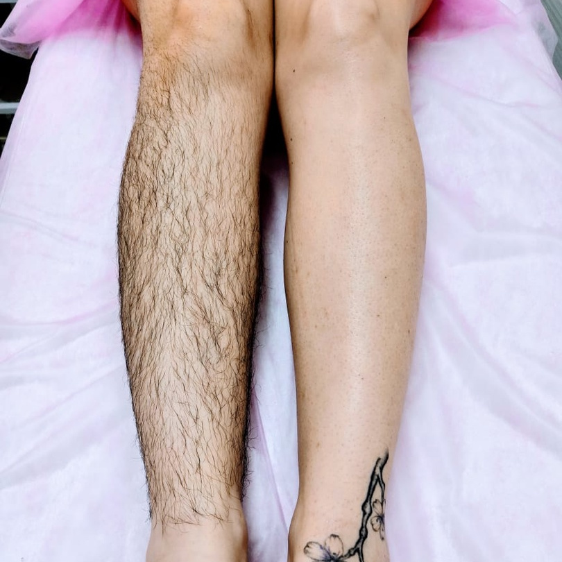 Депиляция (шугаринг) ноги до колена