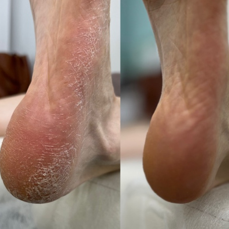 Педикюр (мужской)