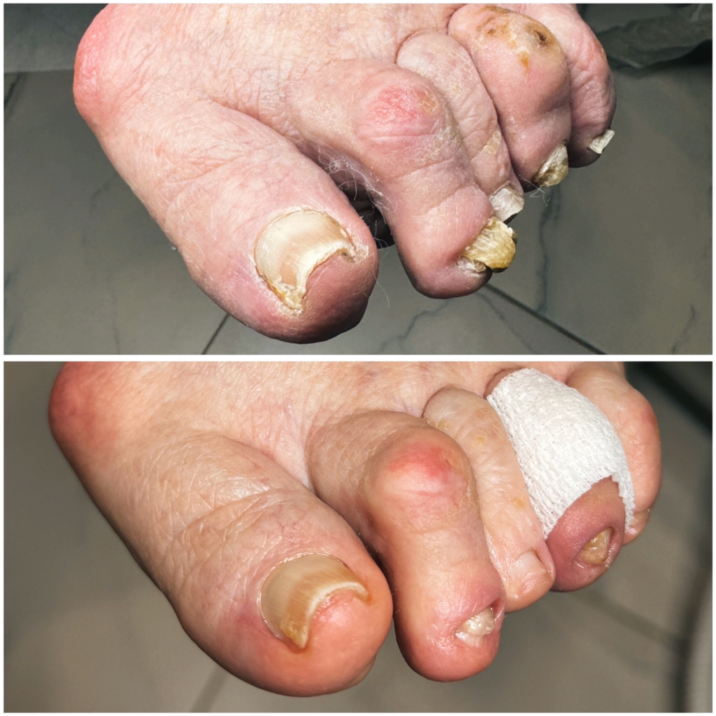 Педикюр «75+»