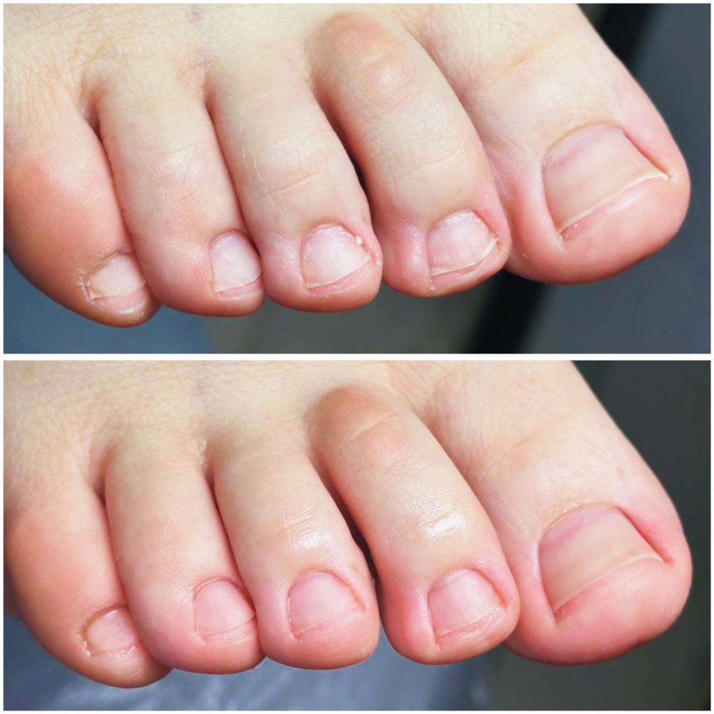 Обработка ногтей (без проблем )